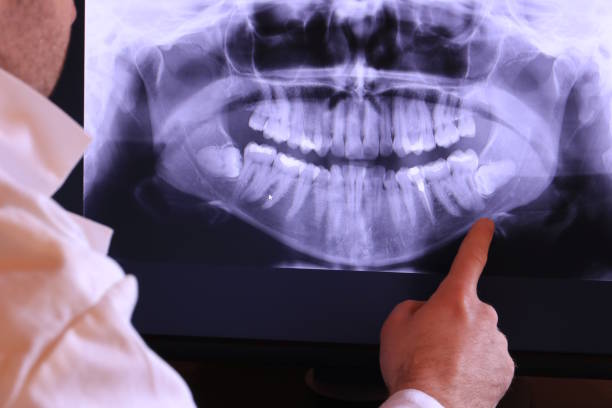 Best Emergency Tooth Extraction in Summerfield, NC