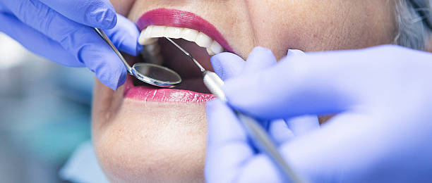 Best Emergency Wisdom Teeth Removal in Summerfield, NC